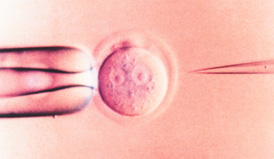 החדרת DNA לביצית